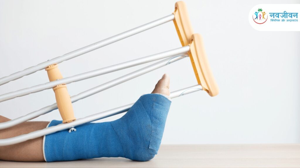 Top Orthopaedic Surgeon in Lalitpur