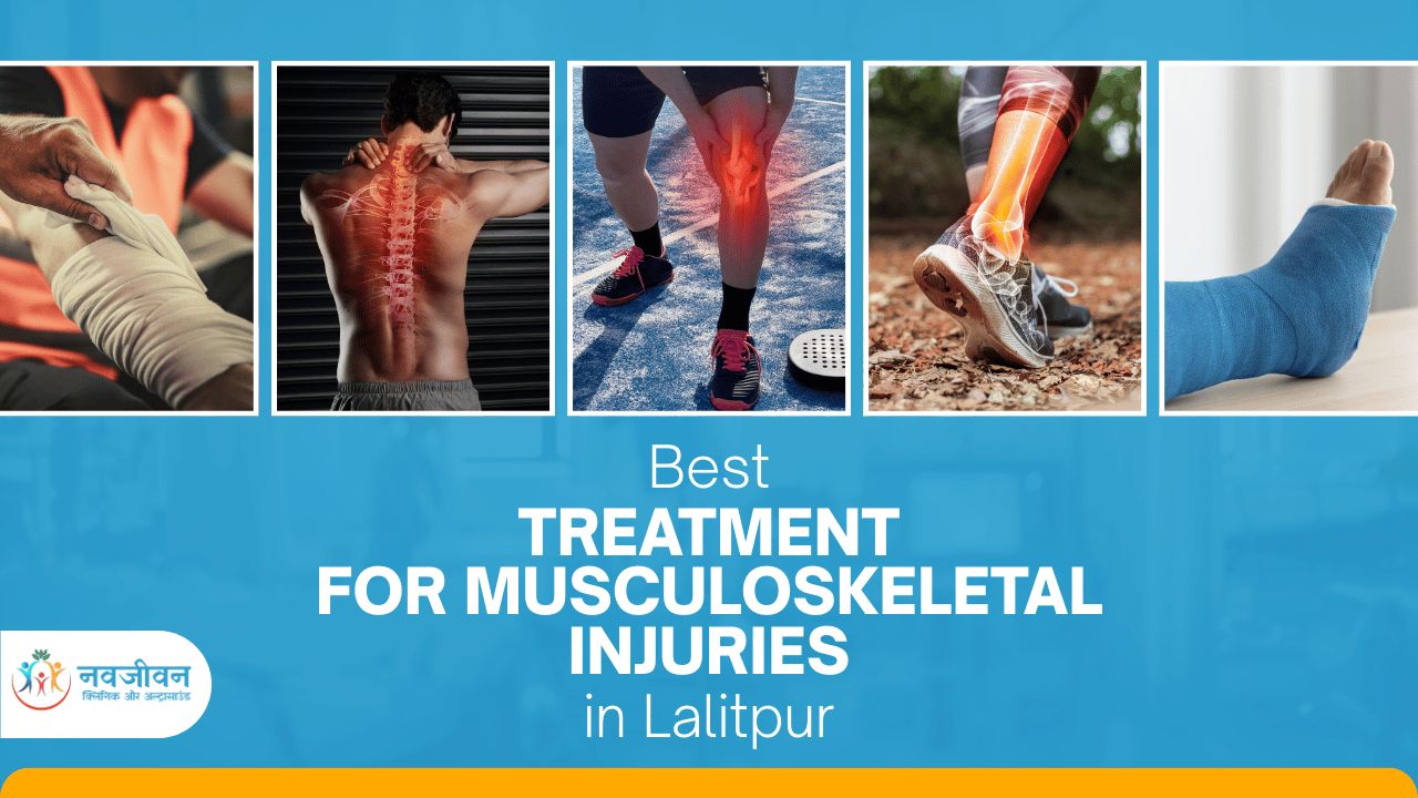 Best Treatment for Musculoskeletal Injuries in Lalitpur